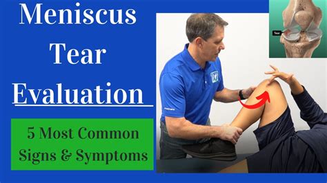 7 test for meniscus tear|how to determine meniscus tear.